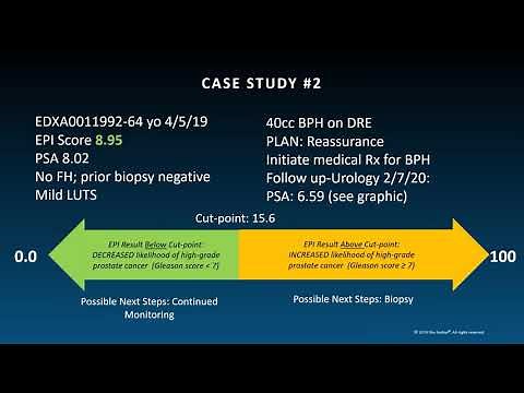 The ExoDx™ Prostate Test: Prostate Cancer and Implications for Value Based Care Part 2