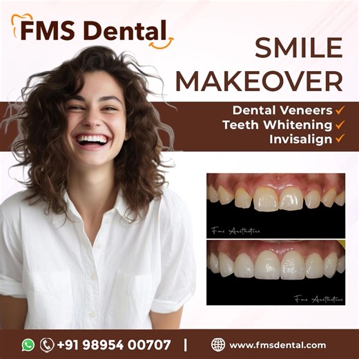 10K views | Your smile is your style. At FMS Dental, we design veneers that blend artistry with precision dentistry at our in-house lab— so your teeth look as good as they feel. ✅ Celebrity-trusted doctors ✅ Advanced labs & painless procedures ✅ Long-lasting, stunning results  Schedule your consultation today. | FMS International Dental Center | Facebook