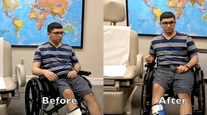 2.4K views · 27 reactions | Rapid improvement in ataxia following...
