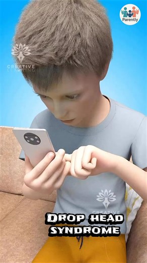Aarush Magrati on Instagram: "📱 Your child’s neck is paying the price for screen time and you may not even realize it.Every time they look down at a phone or tablet for hours, they’re slowly weakening the muscles that hold their head up. This is how Drop Head Syndrome can begin — silently, dangerously. 👶 What Is Drop Head Syndrome (DHS)? It’s a condition where the neck muscles become so weak,the child struggles to lift their head — it stays dropped forward. Imagine not being able to hold your 