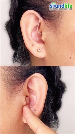 RIC vs CIC: Mana yang cocok untukmu?