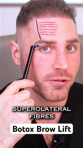 How does a Botox Brow lift work? 💉🤔