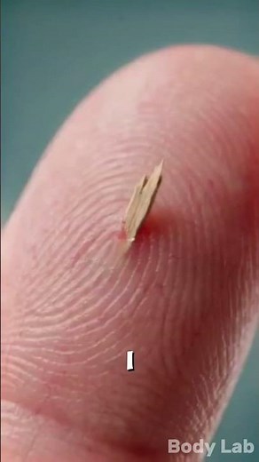 Never Leave A Splinter In Your Skin Here's Why