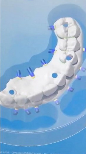 MILLBOX | NESTING | DENTAL CAD #zirconia