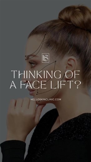 Facelift results — no surgery required? The 8-Point Lift is the secret behind that subtly snatched, refreshed look everyone’s talking about 👀 Minimal downtime. Maximum confidence. 💋 📍 Hello Skin Clinic 21 Sheepcote Street, Birmingham, B16 8AB 📞 0121 714 0999 💌 info@helloskinclinic.com
