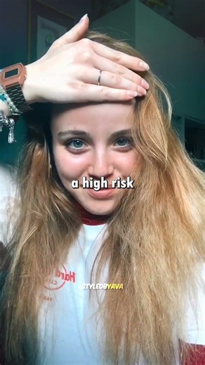 Are You Balding Try This 5 Second Forehead Test 😳🧠