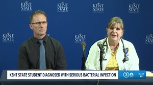 Kent State University student hospitalized with Neisseria meningitidis