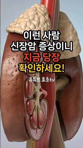 If you see these symptoms, check right now! Early kidney cancer symptoms #KidneyCancer #KidneyCan...