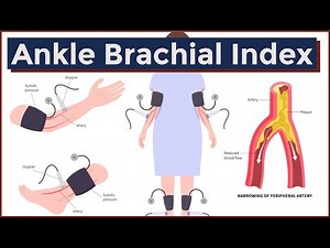 Ankle Brachial Index | Peripheral Artery Disease
