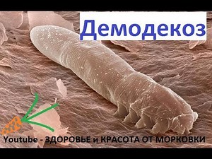 Demodicosis treatment. How to treat demodecosis on the face of the house ?
