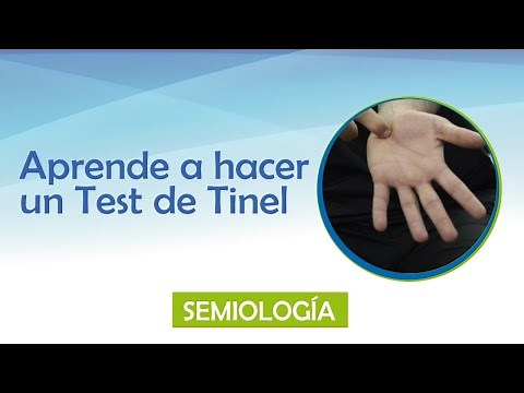 Tinel's test