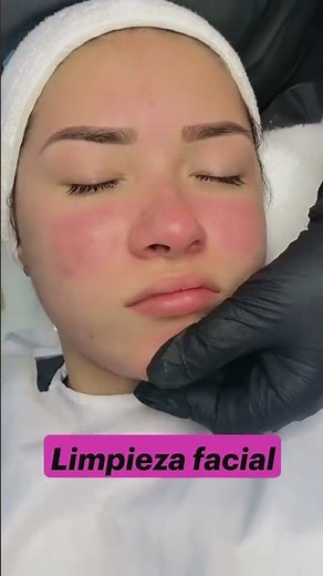 Professional deep facial cleansing | Step by step #facialcleansing