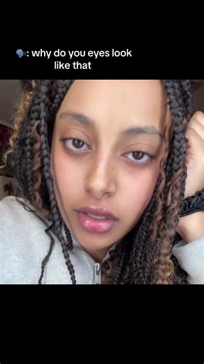 How to Cover Under Eye Bags Effectively