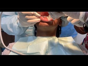 Dental Checkup & Cleaning my Teeth