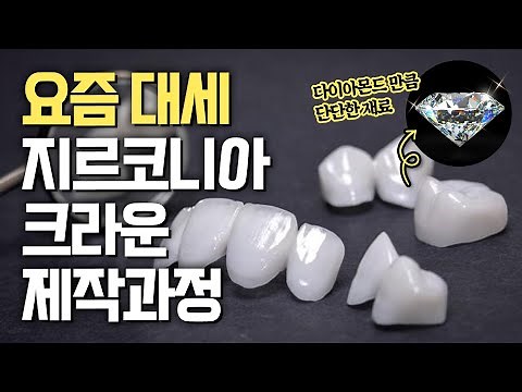 👑지르코니아 크라운 제작과정 A to Z