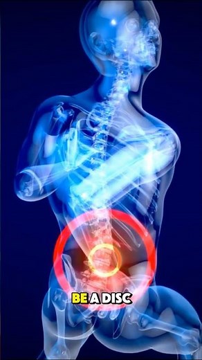 Herniated Disk Removal Surgery – Symptoms #3danimation #symptoms #herniated #herniateddisc #pain