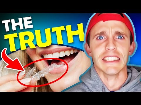 Orthodontist REVIEW of Smile Direct Club..**Watch BEFORE you buy!!**