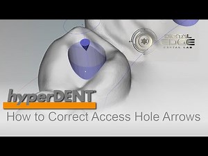 hyperDENT Tutorial: Correcting Access Holes