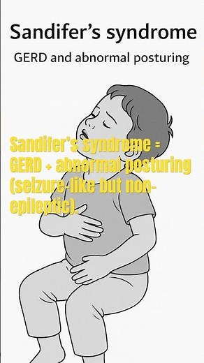 SANDIFER’S SYNDROME