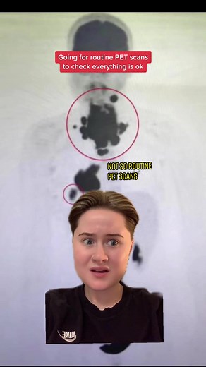 No matter how hard I try it creeps up on me😅 #cancer #tumour #nhs #hospital