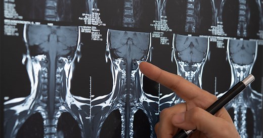 Patient Options to Restore Their Voice After Head and Neck Cancer