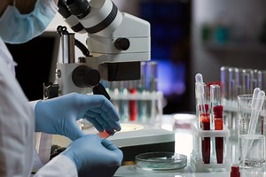 Why Are Lymphocytes and Lab Tests Important?