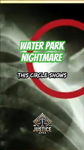 Water Park Nightmare: $1.5 Million Lawsuit Over Terrifying Slide Accident!