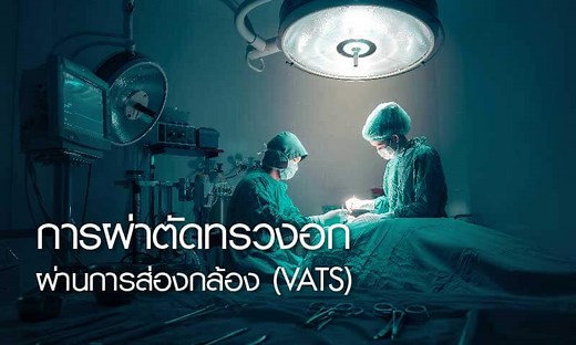 การ ผ่าตัดทรวงอก ผ่านการส่องกล้อง (VATS) คืออะไร - ศูนย์มะเร็งตรงเป้า