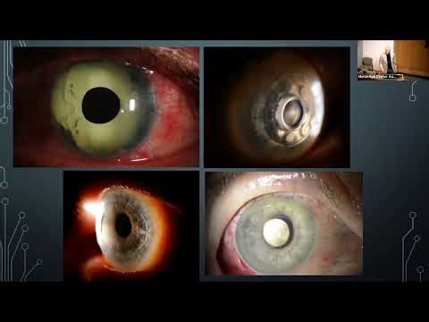 40 Years of Ophthalmic Imaging