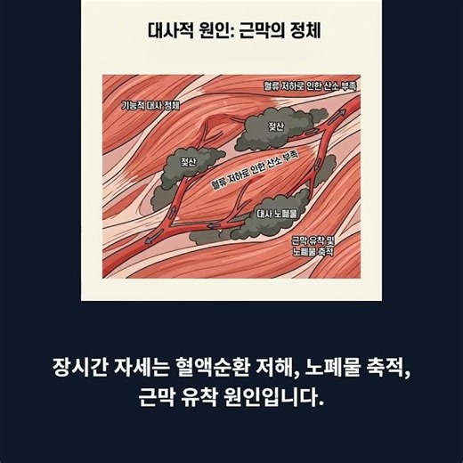 장거리 운전 허리 통증 골반 틀어짐 교정 추나치료 허리 삐끗했을 때 대처법