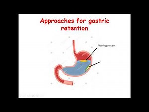 Approaches for gastroretentive drug delivery system formulation