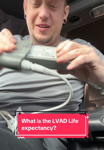Understanding LVAD Life Expectancy and Living with It