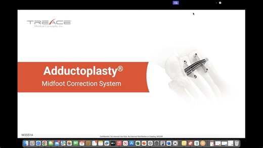 M3551A_Adductoplasty® System Overview with Dr. Jody McAleer