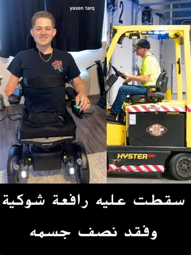 ‎عالم الحكايات _ Hikayat World‎ on Instagram‎: "في عام 2019، تعرّض لورين شاورز لحادث مروّع بعدما سقطت عليه رافعة شوكية من ارتفاع 50 قدمًا، مما أدى إلى انشطار جسده إلى نصفين. كانت إصاباته مروّعة للغاية، إذ فقد كلتا ساقيه وجزءًا من ذراعه اليمنى. اضطر الأطباء إلى إجراء عملية جراحية نادرة تُعرف باسم "استئصال نصف الجسم السفلي" (Hemicorporectomy)، وهي عملية إنقاذ للحياة تتطلب بتر النصف السفلي من الجسد بالكامل بالإضافة إلى ذراع واحدة. كانت رحلة لورين نحو التعافي طويلة وشاقة، وتضمنت العديد من العلاجات و