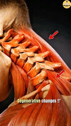 Stop This Mobile Mistake ❌ | Neck Pain ka Real Reason (Science Explained) #neckandshoulderpain
