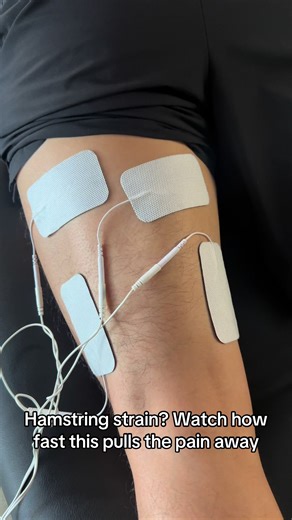 Hamstring injuries don’t have to keep you sidelined. Cupping boosts blood flow speeds up healing and melts away muscle tension. So you can recover faster stronger and better. Ready to try it yourself? 👇👇 #cuppingtherapy #hamstringrecovery #fasthealing #sportsrecovery #cupping
