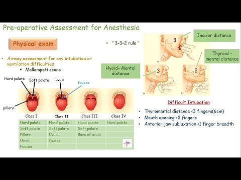 Pre-operative Assessment for Anesthesia - Health Hush