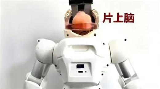 China builds robot with lab-grown human brain dubbed ‘Organoid’ in experiment