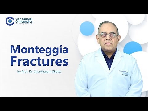 Monteggia Fractures by Prof. Dr. Shantharam Shetty ‪@ConceptualOrthopedics‬
