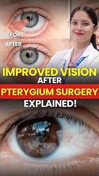What to Expect After Pterygium Surgery? Vision, Healing & Results