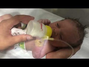 Cute Baby’s First Feeding of His Life 🍼💖 | Loving NICU Moment #NICUBaby #FirstFeed