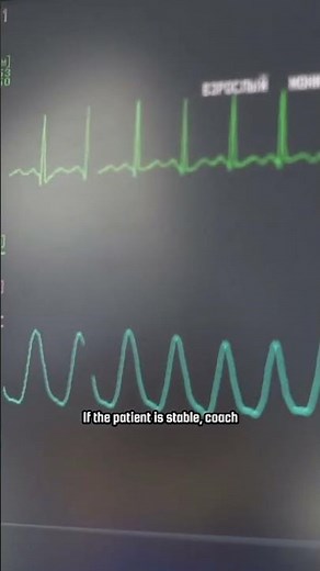 Understanding SVT Management #SVT #ECG #RhythmStrips #CardiacNursing #NCLEX #Shorts