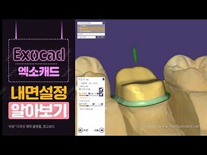 Dental technician exocad internal settings - basics 4