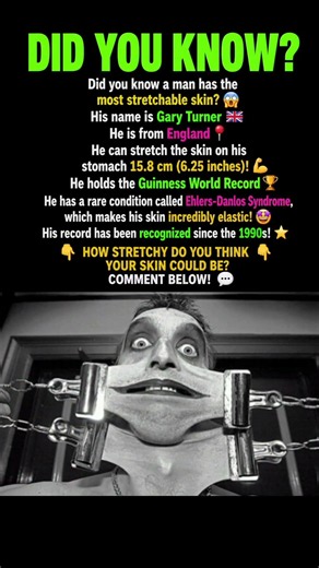 This man has the world's most stretchable skin! Would you dare try this? 🤯 #DidYouKnow #worldrecord