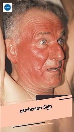 Dr Medica Clinical Case || Pombertin Sign || Clinical Medicine || Medical Knowledge