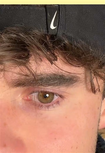 White Film on Eyebags: Product Deception