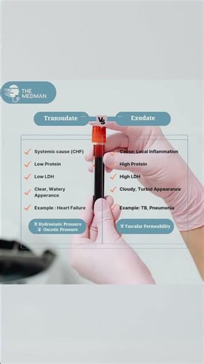 Transudate vs Exudate | #shorts #viralvideo #mbbs #medicine #education #study #doctor #medicos