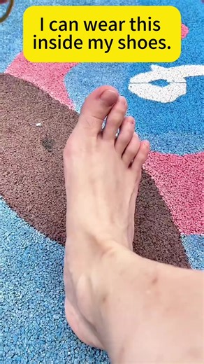 Comfortable Solutions for Bunions with Hallux Correction