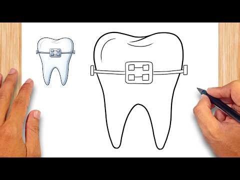 How to draw Dental Braces - Easy Drawing for Kids & Beginners