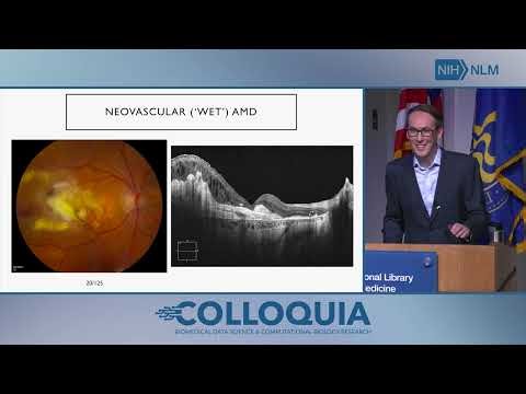 Diverse Applications of Computational Research and Artificial Intelligence in Ophthalmology